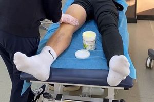  理疗在篮球运动员心理恢复中的关键作用及最佳策略